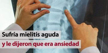 Artículo: Sufría mielitis aguda y le dijeron que era ansiedad